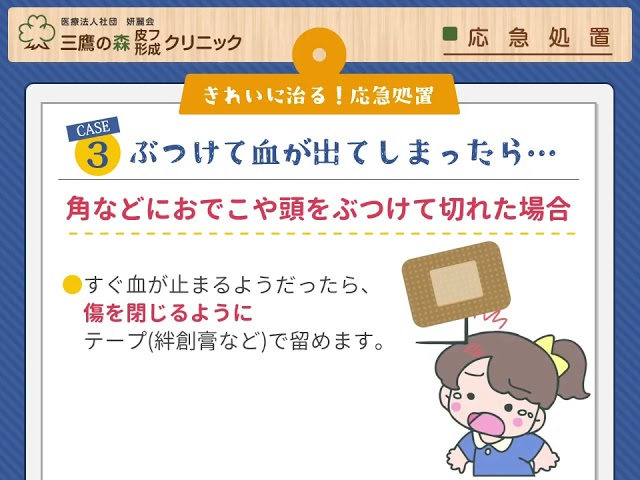 YouTube サムネイル